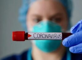 Coronavirus Virus Covid 19 Koronavirus Virus Probirka Test Tube Laboratoriya Laboratoriya Laboratory 1024x583