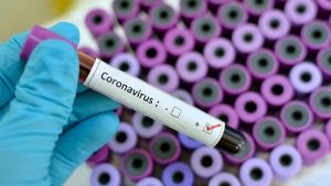 2020 02 24 Coronavirus Russian